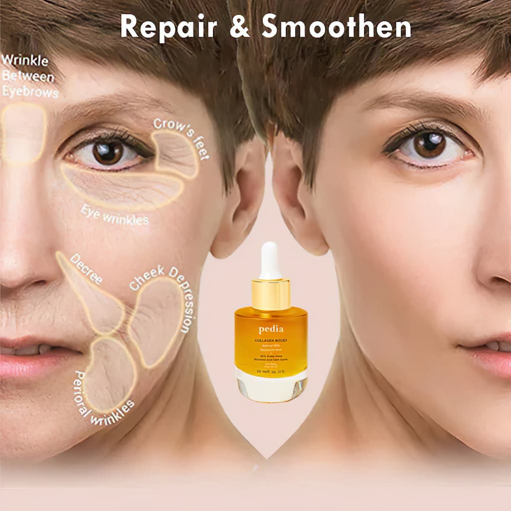 Pedia™ - Collageen Booster Serum (1+1 Gratis) 