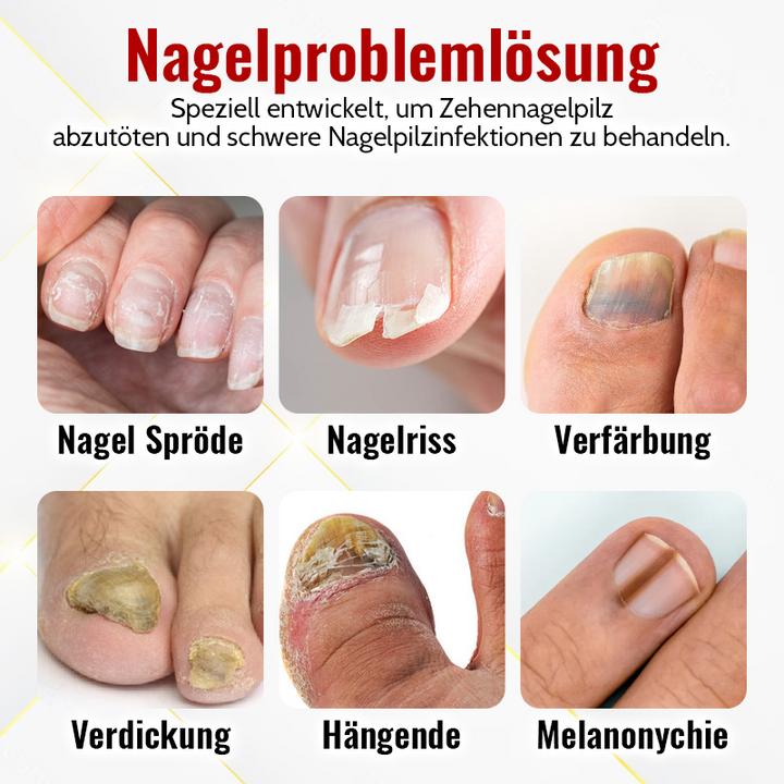 1+1 Gratis | NailSaver™ Onychomykose Rapid Relief Olie 