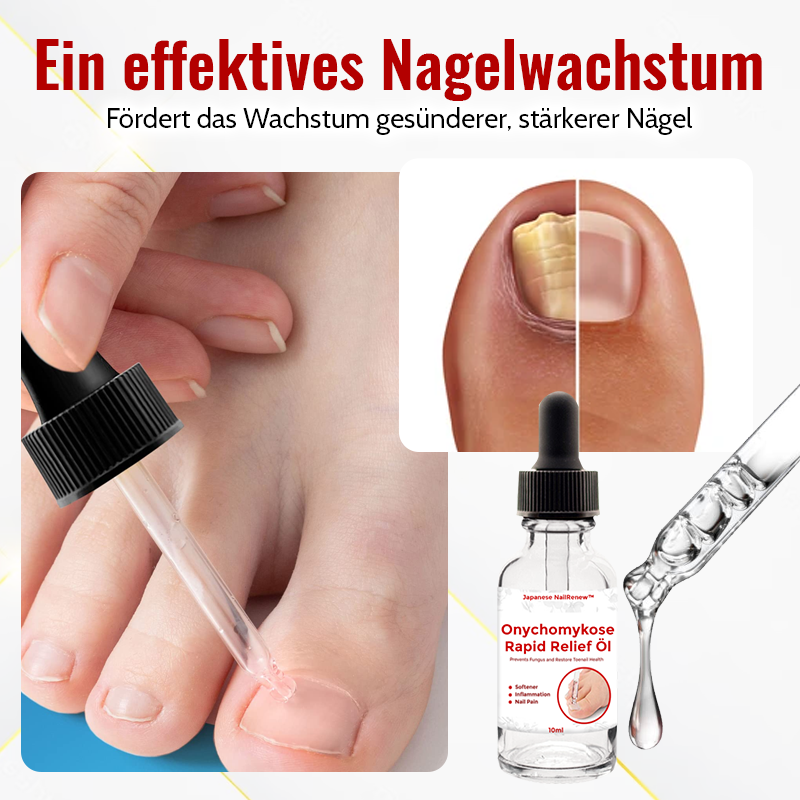 1+1 Gratis | NailSaver - Onychomykose Rapid Relief Olie