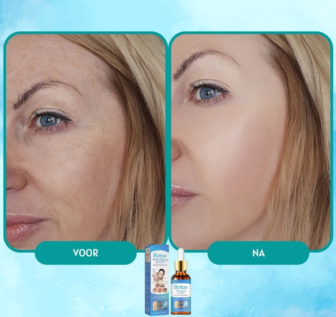 YouthGlow™ - Botox Antiverouderingsserum | 1+1 GRATIS TIJDELIJK 