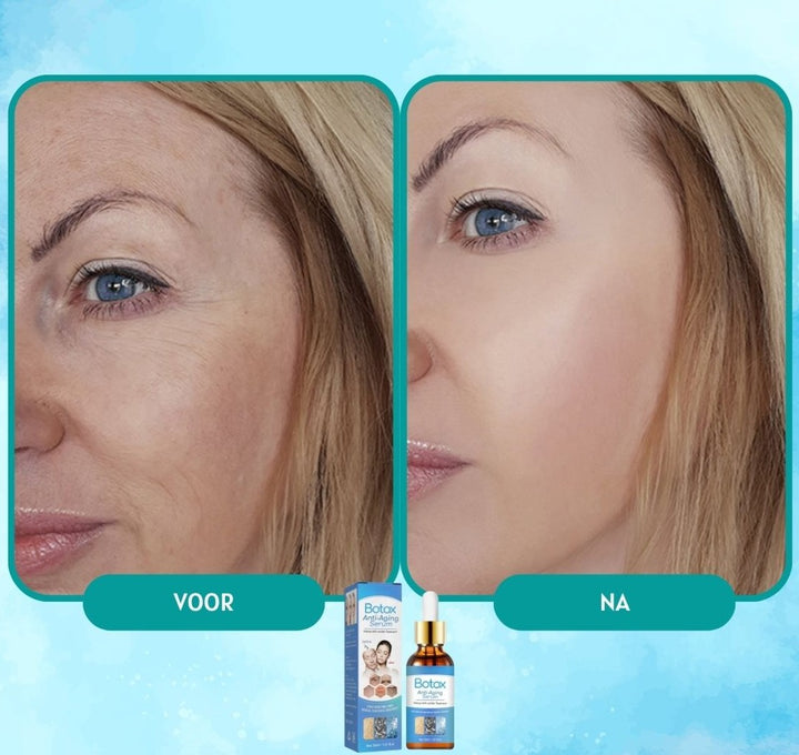 YouthGlow - Botox Anti-verouderingsserum | 1+1 GRATIS TIJDELIJK