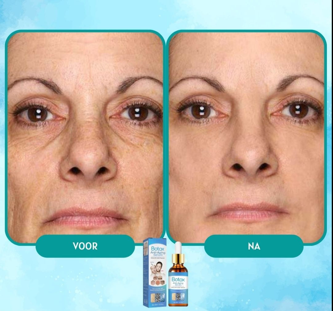 YouthGlow - Botox Anti-verouderingsserum | 1+1 GRATIS TIJDELIJK